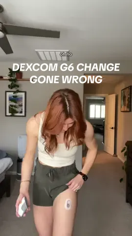 lets also pretend like this didn’t ruin my blood sugar readings for the rest of the day #t1dlookslikeme #type1diabetes #diabetescheck #dexcomg6 