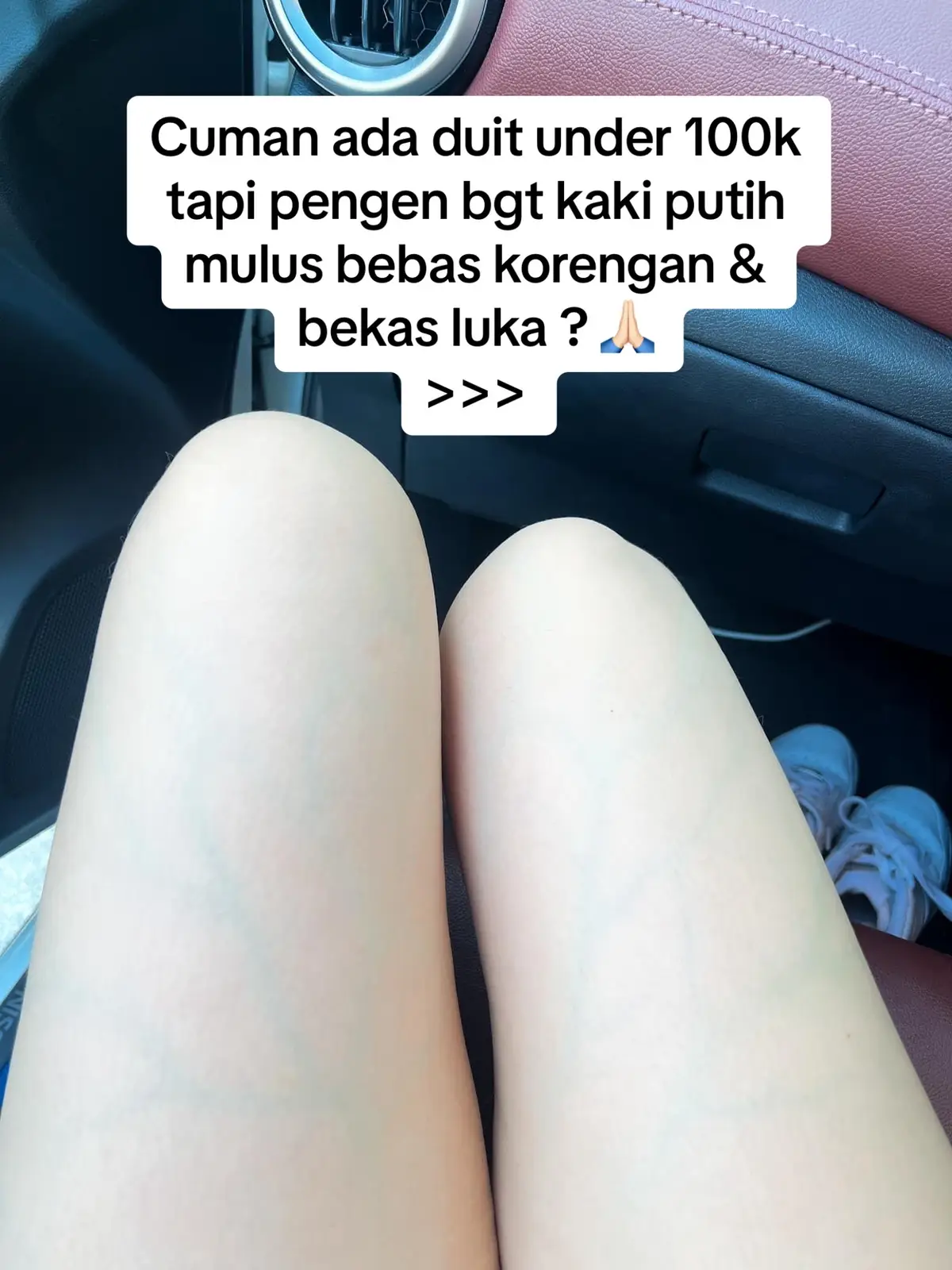 Makasih racun tiktok di tahun 2024 ter worth it yang pernah ku coba 💚👍🏻 #fyp #fypシ #foryou #fairyscrub #fairyglutascrubsoap #lulurpemutihbadan #lulurthailand #pemutihkulit #kulitputih #tipsputih #pemutihampuh #produkviral #produkthailand #pejuangkulitputih 