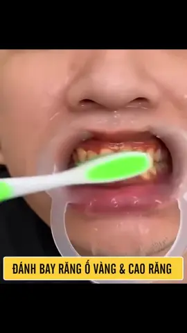 Hàng kem đánh răng này được nhiều người thích lăm anh chị em a! Hàng bên e lại về tiếp để phục vụ anh chị em nha#kemdanhrang #vệsinh #yayashi #lamdep 