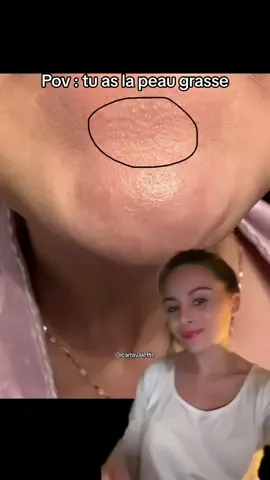 Voici une solution efficace si tu as la peau grasse 