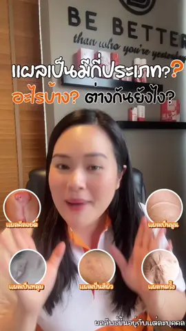 แผลเป็นมีกี่ประเภท? อะไรบ้าง?! แต่ละอย่างต่างกันยังไง? #แผลเป็น #แผลเป็นนูน #แผ่นซิลิโคนลดรอยแผลเป็น #แผลเป็นคีลอยด์ #beautyonsale  