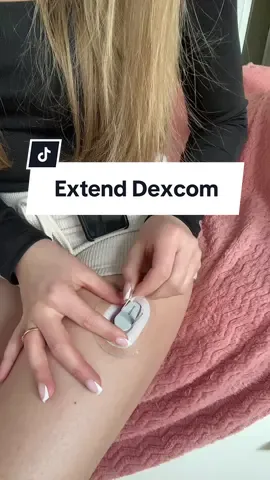 First try to extend the Dexcom 🤞🏻 #dexcom #T1D #try #autoimmunedisease #wishmeluck #type1diabetes #tslimx2 #extend 