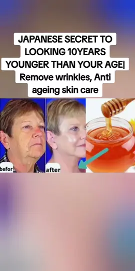 JAPANESE SECRET TO LOOKING 10YEARS YOUNGER THAN YOUR AGE| Remove wrinkles, Anti ageing skin care