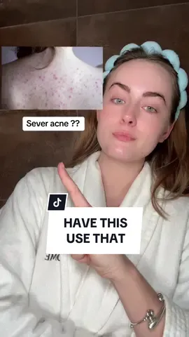 Have THIS?? Use THAT! 🔥 #stretchmarks #acne #strawberrylegs #skintips 
