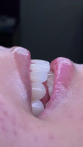 Hiệu ứng tự nhiên kết hợp bàn tay đội ngũ Lab giỏi tạo ra sản phẩm hơn cả mong đợi….🥰 Quý khách hàng quan tâm cứ inbox e nhé #thinhhanh #xuhuong #xuhuong #fypシ゚viral #rangsuthammy #xh #trending 