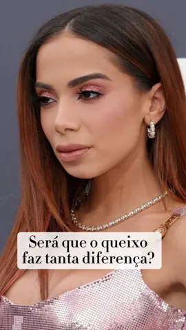 Notaram alguma diferença? O queixo é um pilar na arquitetura do rosto. Uma projeção equilibrada do mento não só define o perfil, mas também traz harmonia e beleza para toda a face. Na harmonização orofacial, avaliamos cuidadosamente o mento do paciente em conjunto com outras características faciais, buscando um equilíbrio que realce a beleza natural e promova um perfil esteticamente agradável e mais atraente. 📞 Quer saber mais sobre como podemos realçar sua beleza natural com a harmonização Orofacial? Comente ‘Mento’ e venha nos visitar para uma consulta personalizada! Transforme sua autoestima com procedimentos seguros e eficazes. Estamos aqui para ajudá-la (o) a alcançar o perfil dos seus sonhos! #harmonizacaofacial #belezanatural #famous #fyp #mento #preenchimento #harmony #antesedepois #preenchimentolabial 