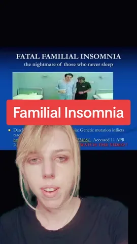 #insomnia #prions #medtok  #weirdmedicalfacts #insomniac #greenscreen 