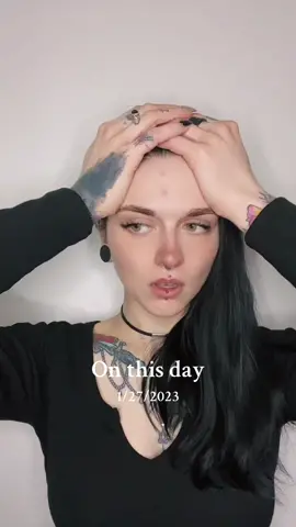 #onthisday This was obviously pre-dermatologist #fyp #thisis30 #imthemaincharacter #humor #funny 