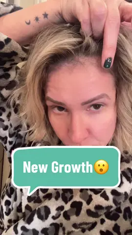 Another side effect of going through the change of life😉 Hair loss is a real issue for a lot of women and men. This product that I’m talking about is not designs specifically for women going through menopause. It is a hair loss stimulant, so male or female. You can definitely give it a try. Grab the link on my homepage to shop. Let me know if you’ve tried it if you’re using it or what you think of it #HairLoss #Menopause #WomenInMenopause #thinhair #thinhairproblems #beautysolutions #pjstylin 