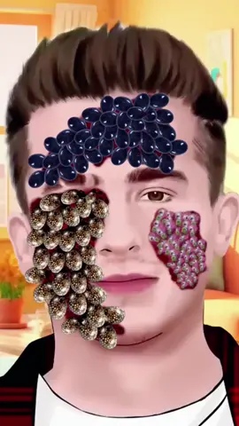 Maggots Cleaning of Charlie Puth Face… Don’t Miss the aend!! #charlieputh #britishsinger #englishsinger #asmr #facecare #cleaningvideos 