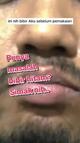 Punya masalah Bibir hitam karena faktor genetik atau yg suka Ngudud??  bibir hitam bikin ga pede kiss sama ayang?? Sinih2, simak video ini sampai habis yaaa. Masalahmu terselesaikan hanya dalam waktu 2 Minggu dengan pemakaian teratur 👍👍 #fypシ #fyp #Lipserum #lipbalm #cowokganteng #bibirkering #bibirhitam #kissablelips 
