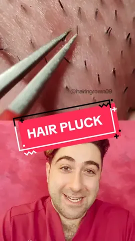 #duet with @hairingrown09 #ingrownhair #tiktokpoll #pimplepop #pimpleremoval #pimplepopper #pimple #whiteheads #whiteheadremoval #whitehead #blackhead #cyst #blister 