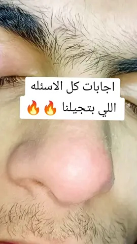اجابات علي كل الأسئلة بتاعتكم ❤️ #trend_barbershop #تنضيف_بشرة #رؤوس_سوداء #skincare 
