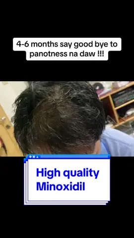 Very confident na irecommend sainyo ito. Baby hairs makikita agad tumubo at sobrang naglessen ang hair fall 😁😁 #misswiss #hair #hairgrowth 