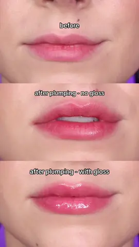 #AD 🌶️ Plumped lips WITHOUT the filler thanks to the @Maybelline New York Lifter Plump Gloss with chilli pepper & hyaluronic acid 🔥 It gives you the TINGLES and the plumping effect is insane!! Try it now - all 8 shades available from TikTok Shop #LifterPlumpGloss #Maybelline #MaybellineLifterGloss #lipplumpinggloss #tryon #lipplump #lipswatches 