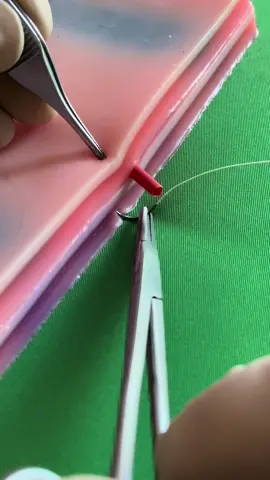 Figure-of-8 stitch for vascular ligation