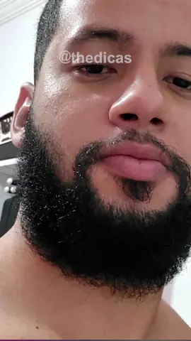 A evolução com Minoxidil do Erik pode ser conferida com mais detalhes no vídeo 117 de evoluções, que já está publicado no canal. #minoxidil #barba #barbearia #barbeiro #barbudo #barbudos #barbado #barbados #lenhador 