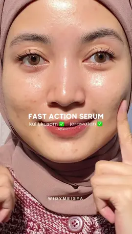 Fast action serum buat jerawat! 🤏🏻✨ #widymeisya #rekomenwidsky #racunwidmey #skincarewidy #OMGSkincare #BeautyNeverFade #CantikTanpaTapi #OMGMugwortSerum #OMGSkincare #SerumTanpaTapi #omgwidy @OMG 