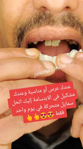 #moroccotiktok #الداربيضاء #الرباط_طنجة_اسفي_فاس_مكناس #algerie_tunisie_maroc #مراكش_المغرب #مراكش_المغرب #الرباط_سلا_المغرب🇲🇦 #فرنسا_اوروبا_اسبانيا_ايطاليا #فرنسا🇨🇵_بلجيكا🇧🇪_المانيا🇩🇪 #فرنسا_بلجيكا_هولندا_المانيا #المانياااا #الخريبكة #casablanca🇲🇦🇲🇦🇲🇦🇲🇦🇲🇦 #الجديدة #casablancaoficial🇲🇦🇲🇦👮‍♂️🚓🚨🧽 