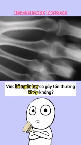 Bạn có hay bẻ ngón tay kêu rắc rắc không? #meohay #meovat #xuongkhop #suckhoe #healthcaretop2toe #trending #viral #xuhuong #tiktok