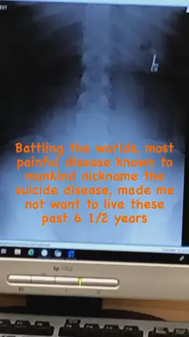 Thank you for saving my life @evil_n8te I wouldn’t still be here without you! #crps #crpsawareness #prowrestling @Evil Nate 