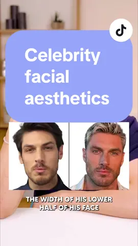 Let’s take a look at Chris Appleton #facialaesthetics #chrisappleton #filler #jawfiller