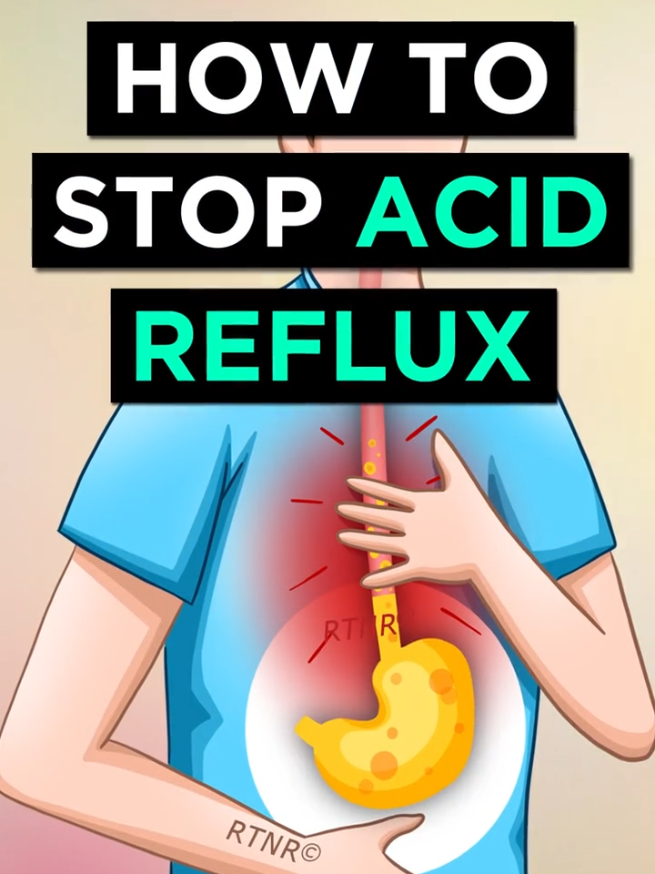 4 Ways To STOP Acid Reflux Permanently #acidreflux  #acidity  #GERD  #naturalremedies  #reflux  #ryantaylornaturalremedies #stomachacid #heartburn #heartburnrelief