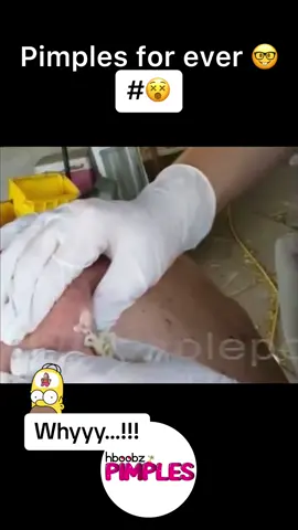 #pimple #medical #horror #blackhead #bigpimple #pimpleremoval #disgusting #pimplepop #cystexplosion #squeeze #squeezeyuk #skincare #acnetreatment #acne #pimples #satisfying #whiteheads #abscess #verysatisfying #cyst 