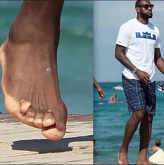 Lebron James and James Harden's feet after years of playing professional basketball. The real reason some professional basketballers' feet are this way is because they go through an absurd amount of strain during training or game. #pinterest #aesthetic #pinterestaesthetic #archive #internet #interesting #background #fyp #foryoupage #fypシ #viral #trending #Lifestyle #fashion #trend #internetarchive #cool #NBA #lebronjames 