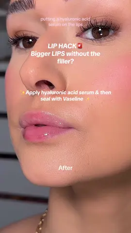 ad want bigger LIPS without filler?? Using @L’Oréal Paris hyaluronic acid eye serum💦. #lorealparis #hyaluronicacid #lipfillers #lipfiller #makeuphack #skincare #lipplumper 