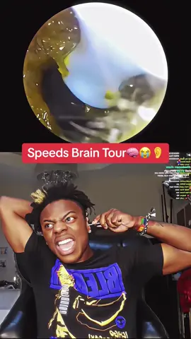 iShow ear wax😳#speed #earcamera #ishowspeed #viral #fyp 