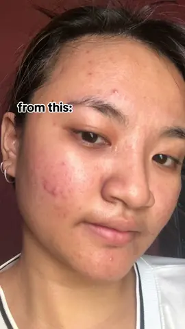 Human Nature ❤️ #axellafatima #humannaturemoisturizer #humanheartnature #hyaluronicacid #ceramidemoisturizer 