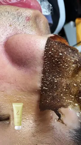 SO satisfying 🤩🤩 #porecleanse #largepores #unclogpores #glowingskin #cloggedpores #cleanskintips #skincare #relateablecontent