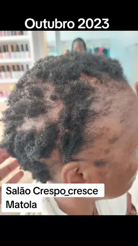 Temos tratamento para Queda Capilar no Salão Crespo_cresce. Estamos localizados nos semáforos da Shoprite da Matola em frente a Construa, no complexo de lojas do restaurante Bibos  Para melhor explicação contacte-nos 844045793 ou 877045793 ou 833339852 #matola #salaodebeleza #cabelonatural #recuperarocabelo #quedacapilar 