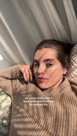 Its so funny because people are over here sharing their daily lives but my days are soOoo consumed by my skin so im over here sharing life as a girl with ✨ #acne 🥲  BUT this is your sign to share the struggles because others are likely going through it too!! #acnegirly #acnegirls #skinblogger #adultacne #hormonalacne #cysticacne #acnehealing #healingacne #accutane #spironolactone #dayinthelife #dailyvlog #relatablecontent 