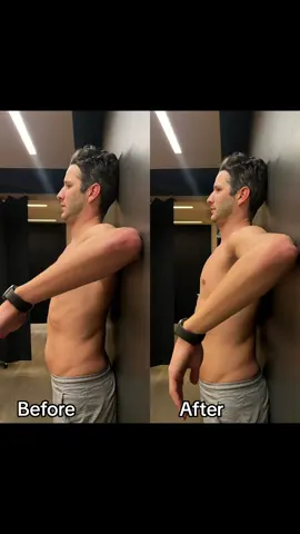 Therapy For Tight Shoulders. Struggling with tight shoulders? You might be experiencing this if you perform a lot of overhead activities like football, baseball, and swimming, as well as desk-bound tasks.  This usually involves tightness in the muscles, ligaments, and joints of the posterior aspect of the shoulder - aka, back of the shoulder. Tight shoulders can hinder your daily activities and sports performance. A focus on hands-on techniques can significantly improve shoulder mobility and decrease tension. Don’t let tight shoulders limit your game or daily life. Take action to reclaim comfort and mobility today. #Myodetox #Shoulders #FutureProofYourBody