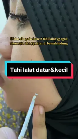 Tahi lalat datar emg bisa?? #swissparislotionoriginal #penghilangkutiltailalat🤭 #penghilangtahilalat #skintag #fypシ゚viral 