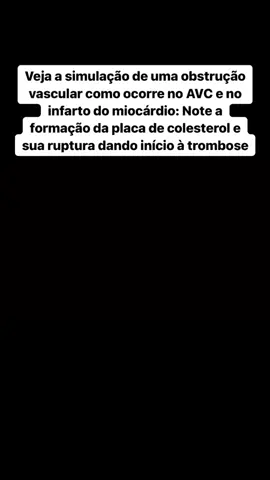 #enfermeriatiktok #enfermagem #estudantedeenfermagem #nurse #tecnicodeenfermagem #saude 
