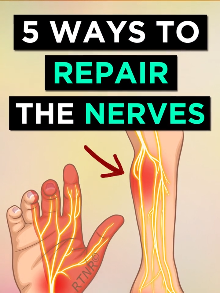 5 Ways To Repair Nerve Damage #nervehealth  #nerves  #neuropathy  #peripheralneuropathy  #repairnerves  #naturalremedy  #naturalremedies  #ryantaylornaturalremedies