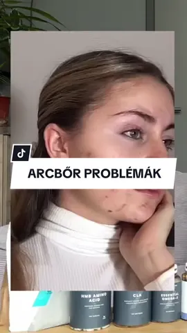 Teljes videó a YouTube csatornámon!🥰🎥 #skin #skincare #biotin #skinglow #arcbor #vitamin #vitamins #myprotein #myproteinhu #myvitamins 