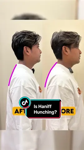 Have you tried fixing your hunched posture? #fyp #chiropractic #asmr 