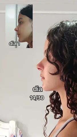 2 semanas  #fy #rino #nariz #massagemfacial #foryou 