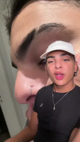 Eu já sofri tanto com queloide em piercing, já testei de tudo, e a coisa mais rapida e eficaz é essa pomada, juro!!!