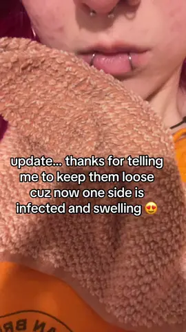 it does not like the change to the hoop #piercings #snakebites #piercingtrouble #lippiercing 