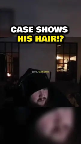 Case with his hair out ☠️😭 #fyp #foryou #caseoh #caseohgames #caseohclips #xybca 