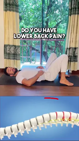 ✅If you’re interested in the lower back pain video course check out the link in my profile🙏 #lowerbackpain #backpain #sciatica #sciaticarelief #lowerback 