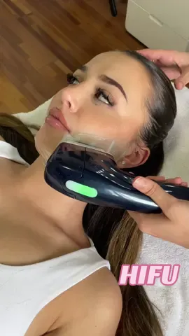 HIFU on the Chin/Jawline! 🔥 results are on my page & also instagram! For bookings please use the link in my bio 🫶🏼 #hifu #hifusydney 