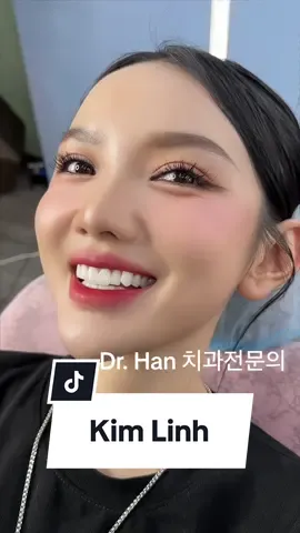 Pé yêu Kim Linh xinh iu trong chiếc răng khểnh mang tên Dr Han #drhan치과전문의 #dansuveneers #nhakhoauytin 