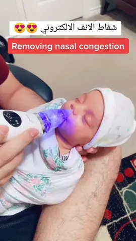 ✅ شفاط اكتروني لتنظيف انف الطفل  يعد شفاط تنظيف الأنف خيارك الأمثل لتنظيف أنف صغيرك من المخاط بطريقة طبيعية ويأتي في علبة يسهل استخدامها أثناء السفر بتصميم أنيق ابتكره الخبراء للتخلص من مخاط الأنف بطريقة فعالة ✅ مميزاته  مرونه عالية من السيلكون المرن لا تؤذي الانف  يحتوي على ٥ سرعات  سريع التنظيف افضل من الطرق التقليدية المؤلمة سهل التنظيف  يدعم الشحن استخدام متعدد ✅ التوصيل لجميع مناطق الضفة والداخل #جهاز_تنظيف_الأنف #اكسبلور #فوريو #كفرمندا #كفر_قاسم #كفركنا #سخنين_ام_الفحم_حيفا_عكا_الناصرة_عرابة #المثلث48 #يافا_تل_ابيب_نتانيا_عكا_حيفا #الضفةالغربية_رام_الله_الخليل_نابلس_ #امالفحم_طيبه_كفرقرع_طيره_باقهالغربيه_ #شفاعمرو_حيفا_عبلين_ناصره #شفاعمرو_حيفا_عبلين_ناصره #الداخل_المحتل_48 #عرب48 #فلسطين 