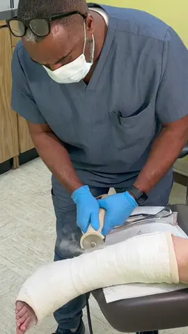 Cast removal #feet #podiatry #footcare #fracture #footinjury #legcast #castremoval #doctorsoftiktok #podiatristoftiktok #feetofticktock 